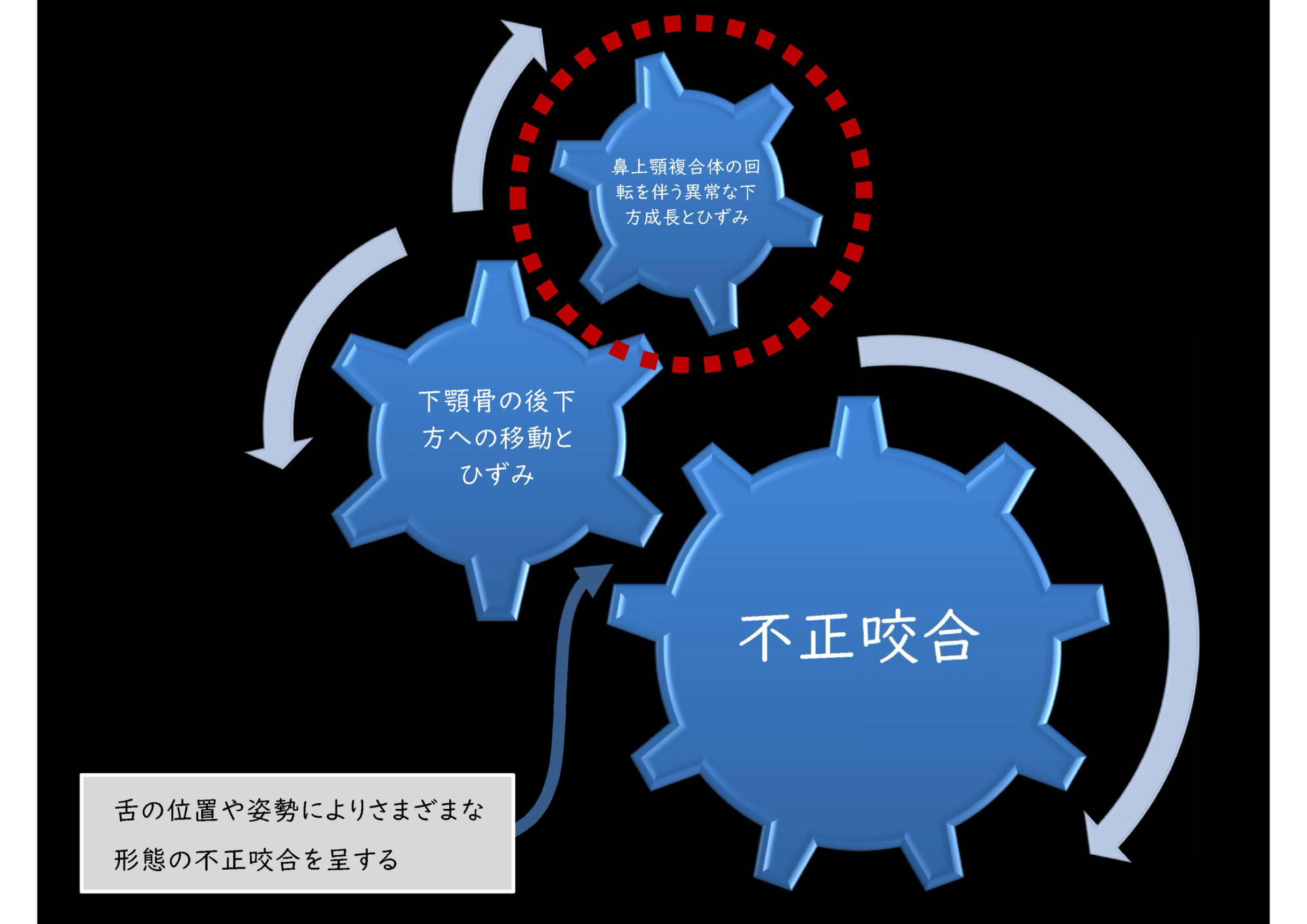 不正咬合が進む仕組み